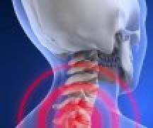 Причины, симптомы и лечение остеохондроза шейного отдела позвоночника