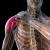 Как избавиться от защемления нерва в плечевом суставе